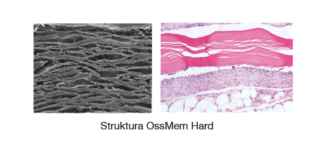 Ossmem hard.png
